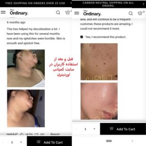 سرم آلفا آربوتین 2% اوردینری ضد لک، آبرسان و روشن کننده پوست 30ML اصل - Image 3