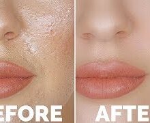 ژل شستشو صورت راکوتن برای پوست های چرب و مختلط thumbnail