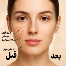 سرم ترنگزامیک اسید ۲٪ و الفا اربوتین ۲٪ دریم رز روشن کننده thumbnail