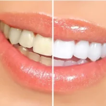 خمیردندان سنسوداین ریپیر اند پروتکت Repair and Protect thumbnail