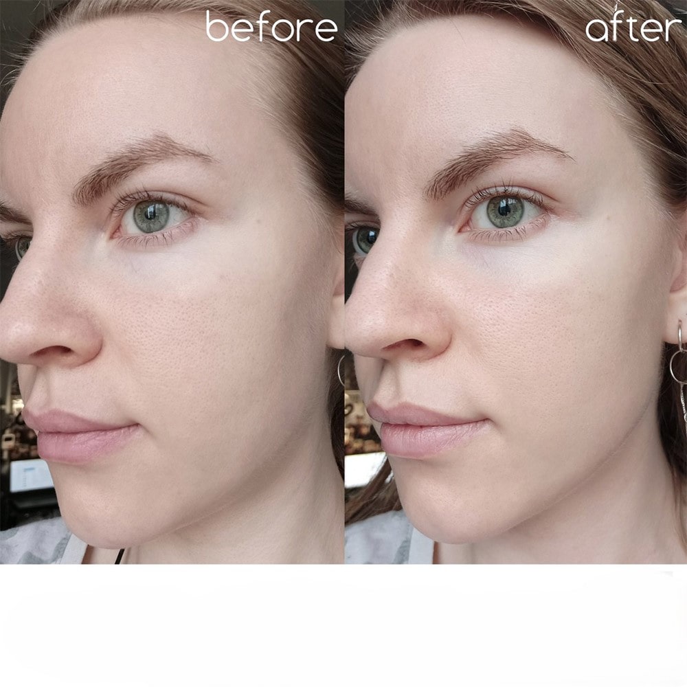 آمپول کنترل منافذ اسکین ۱۰۰۴ اصل کره 100 میل gallery image